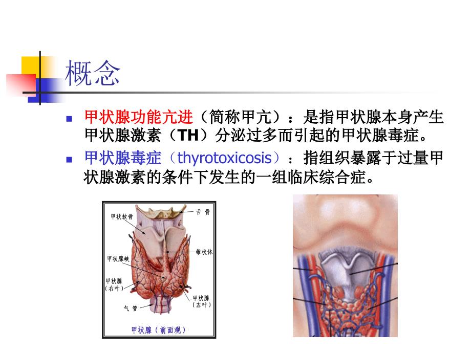 甲状腺 功能亢进症.ppt_第3页