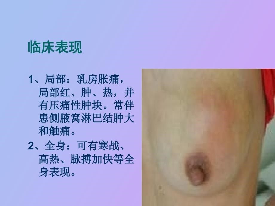 乳腺疾病病人的护理_第5页