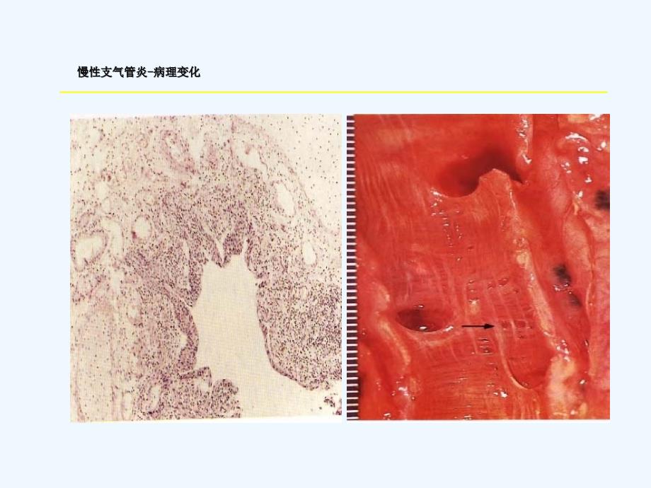 实验七呼吸系统疾病_第4页