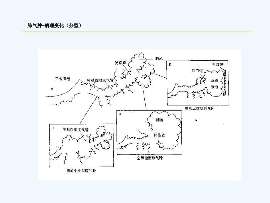 实验七呼吸系统疾病_第5页