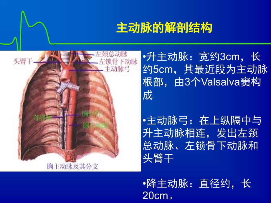 《主动脉夹层》PPT课件_第3页