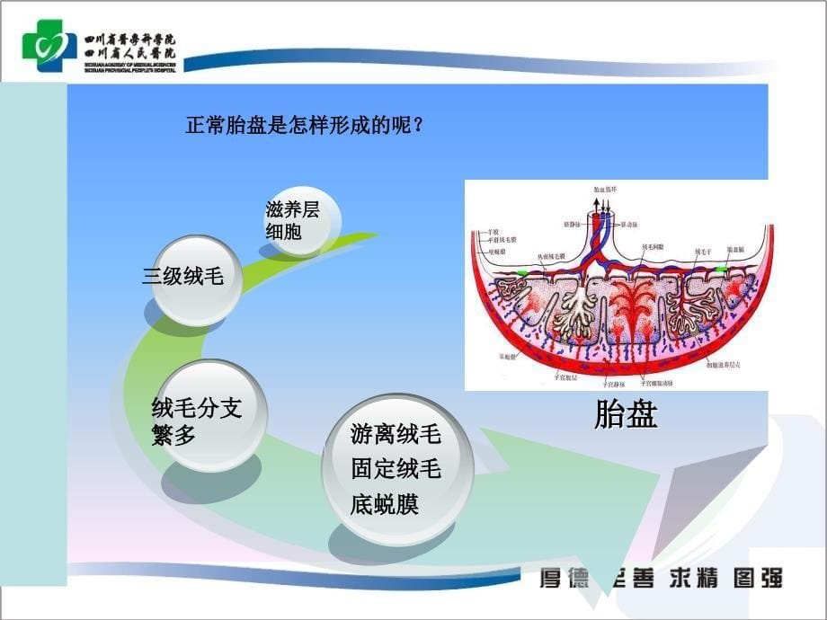 胎儿附属物超声 ppt课件_第5页