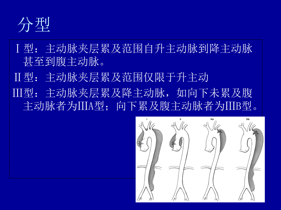 《新主动脉夹层护理》PPT课件_第4页