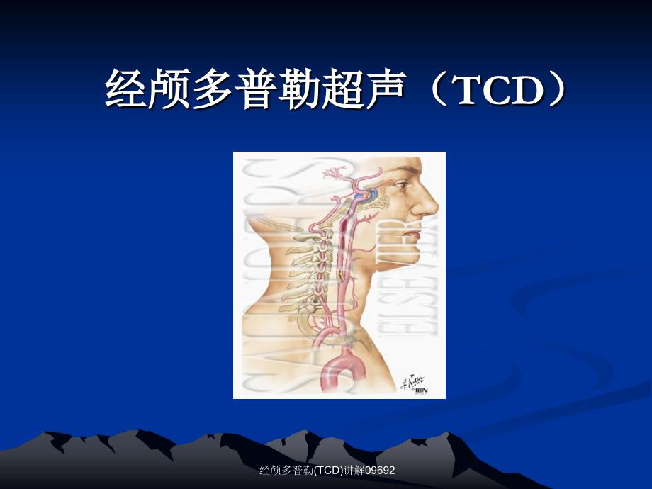 经颅多普勒(TCD)讲解09692_第1页