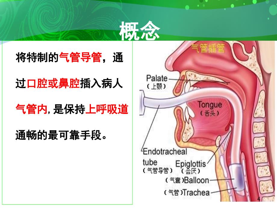 气管插管及困难气道PPT课件_第4页