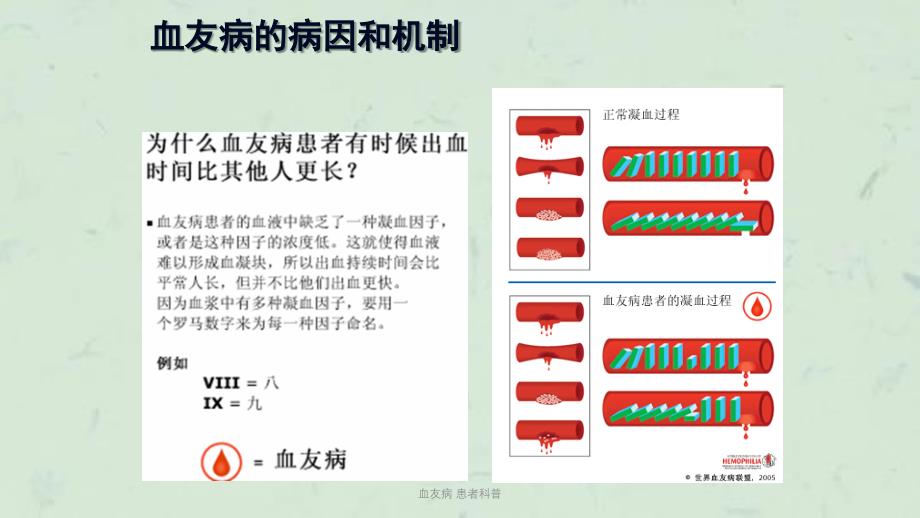 血友病患者科普课件_第4页