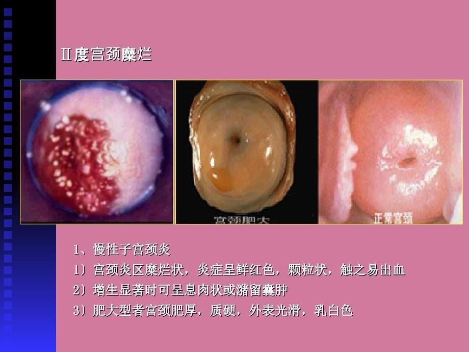 生殖系统疾病实验ppt课件_第5页