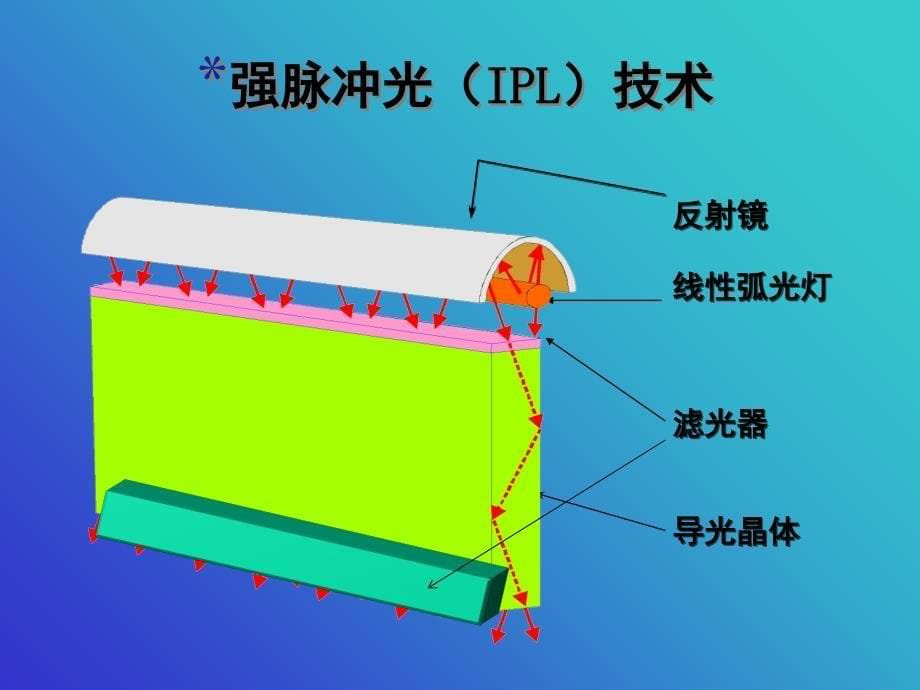 强脉冲光应用进展(课堂PPT)课件_第5页