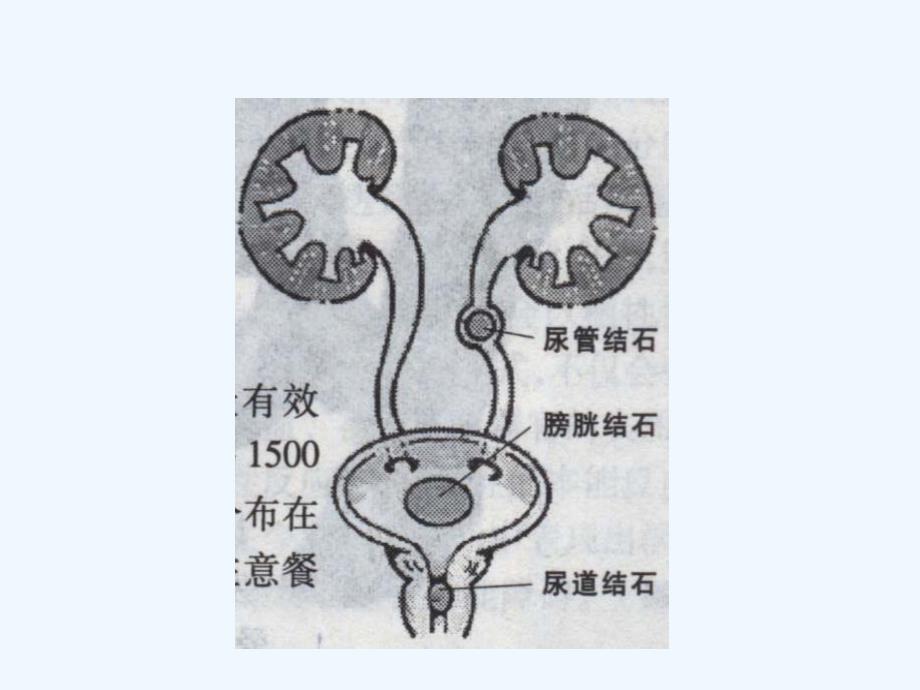 加重肾损害的常见临床因素_第4页