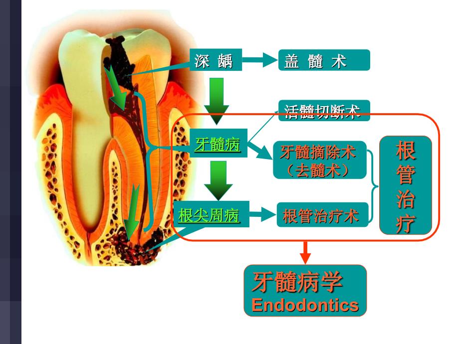 根管治疗步骤方法器械_第2页