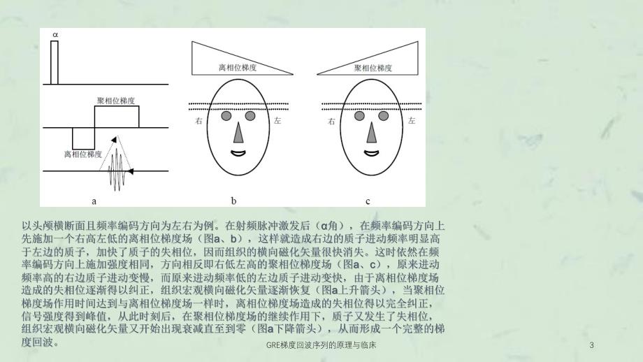 GRE梯度回波序列的原理与临床课件_第3页