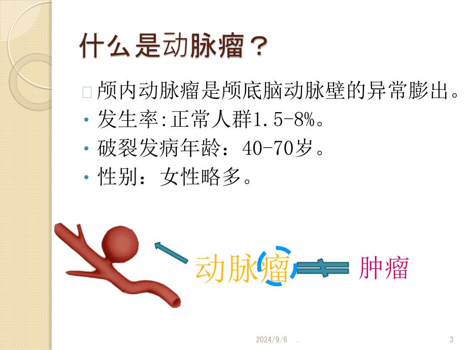 颅内动脉瘤围手术期护理课件_第3页