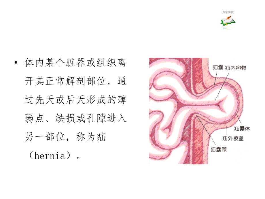 腹外疝ppt演示课件_第2页