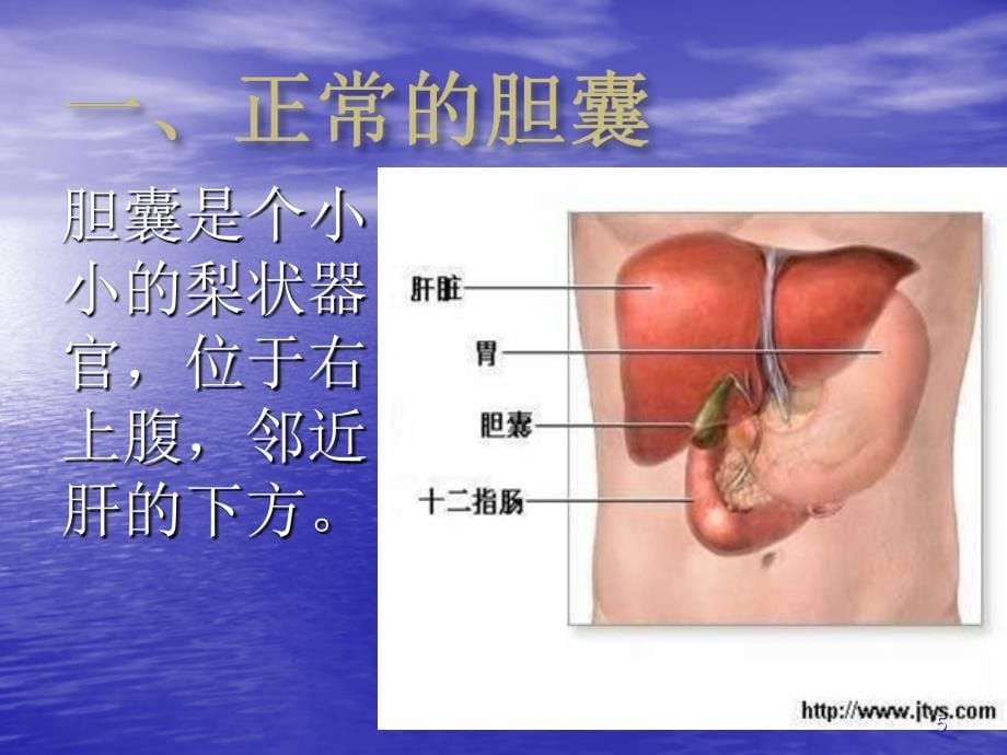 胆囊结石护理ppt课件_第5页