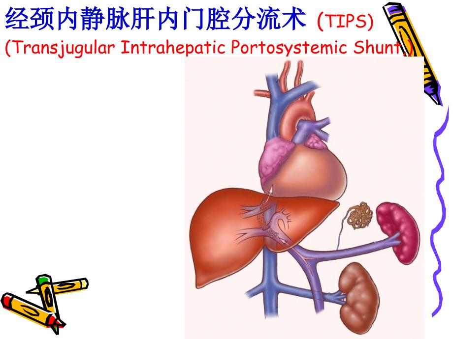 IPS技术报告课件_第2页