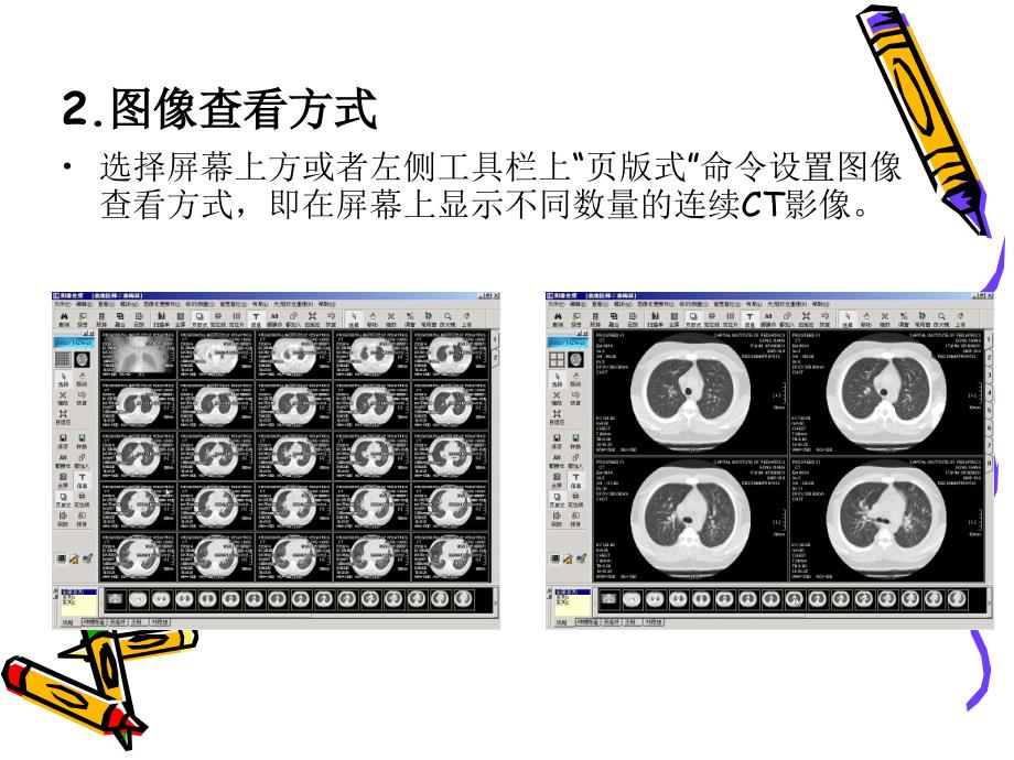 医学图像后处理技术_第4页