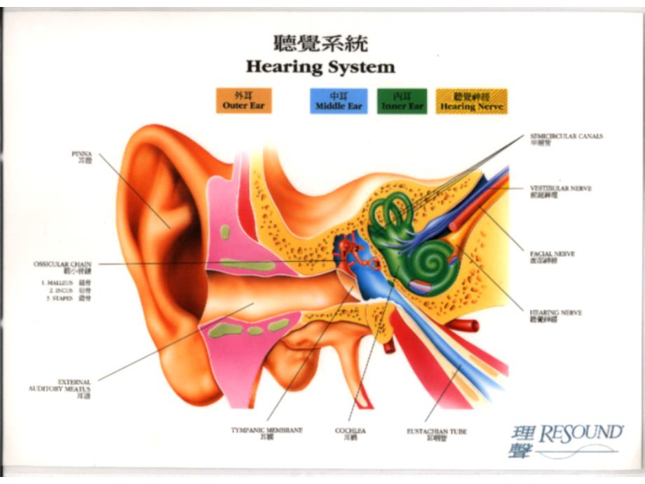 化脓性中耳炎及其并发症.ppt_第2页