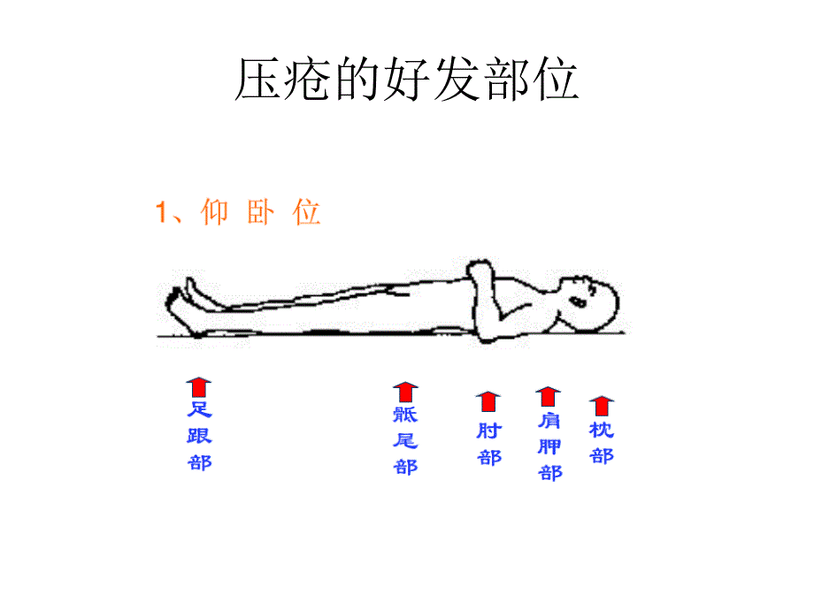 压疮的机理及护理.ppt_第4页