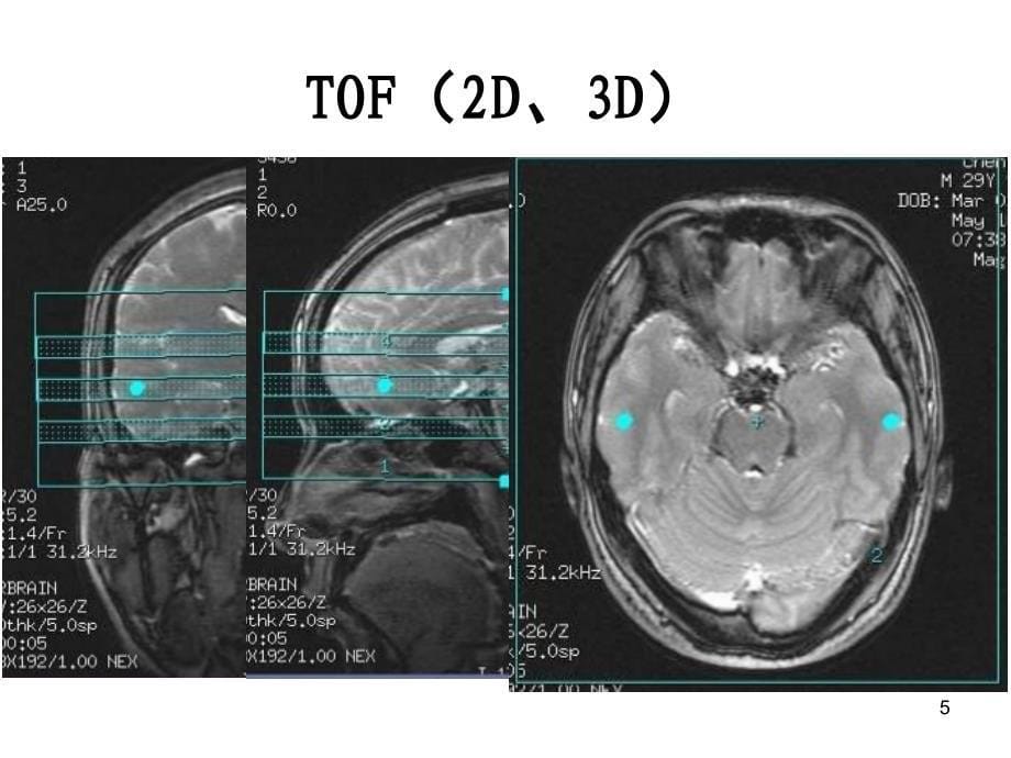 MRI特殊成像技术PPT课件_第5页