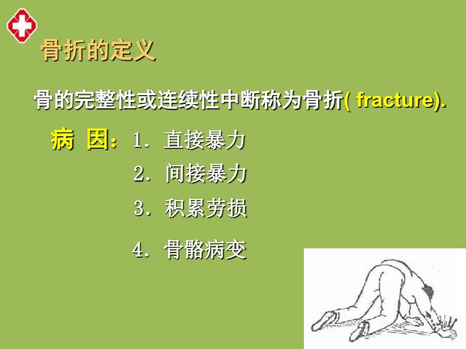 骨折病人的护理ppt_第3页