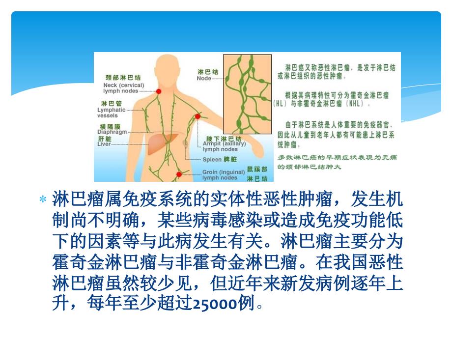 淋巴瘤护理查房ppt课件_第2页