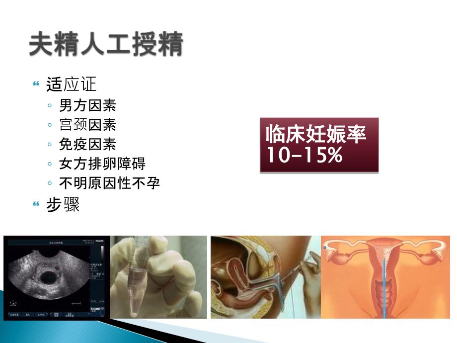 人类辅助生殖技术应用概述.ppt_第3页