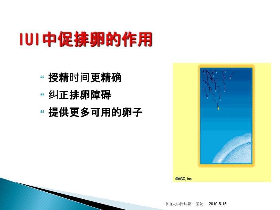 人类辅助生殖技术应用概述.ppt_第5页