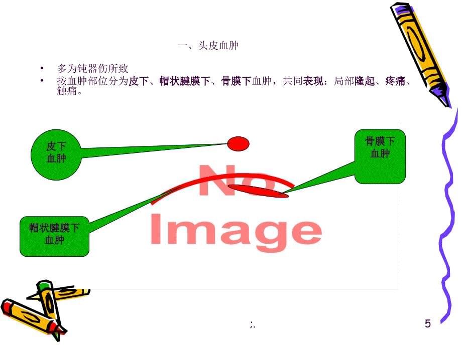 头皮损伤ppt课件_第5页