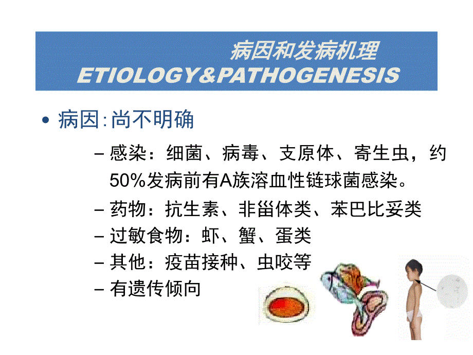 过敏性紫癜个人整理_第4页