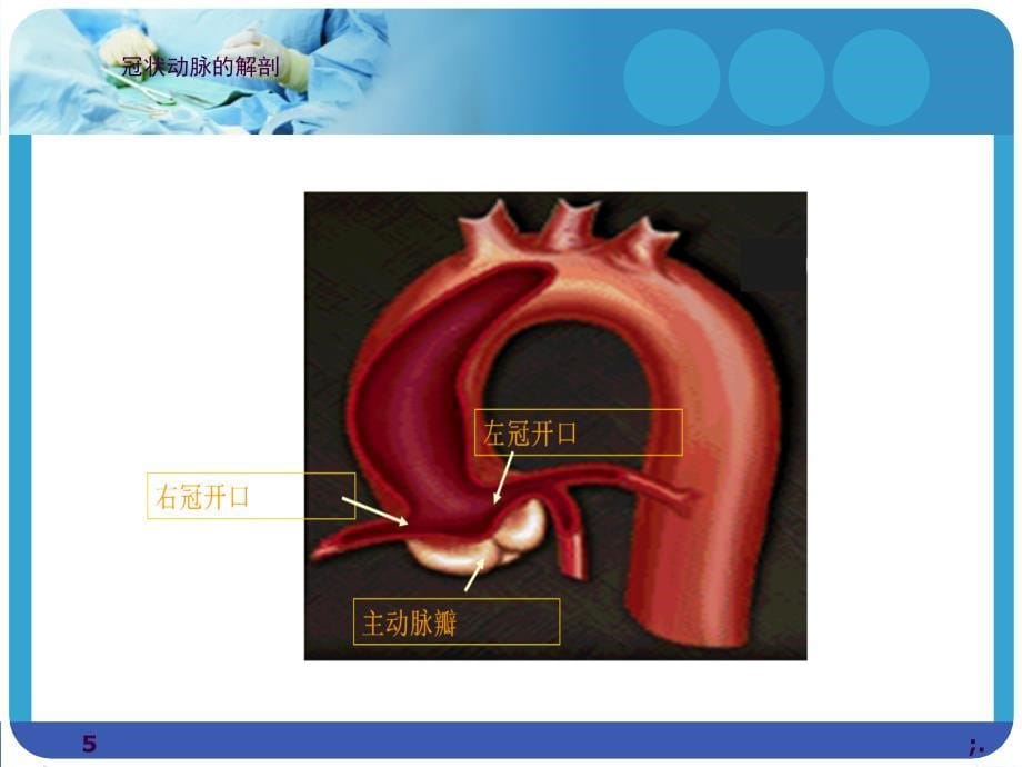 冠脉造影术的护理ppt课件_第5页