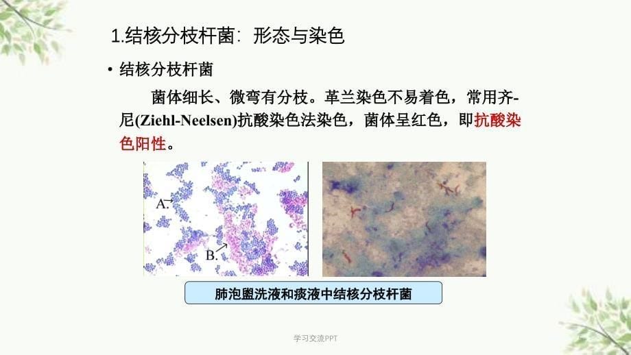 呼吸道感染细菌医学课件_第5页