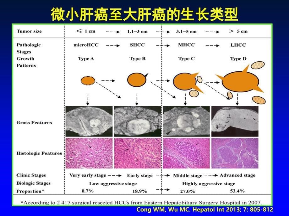 2018最新肝癌诊疗新进展.ppt_第5页