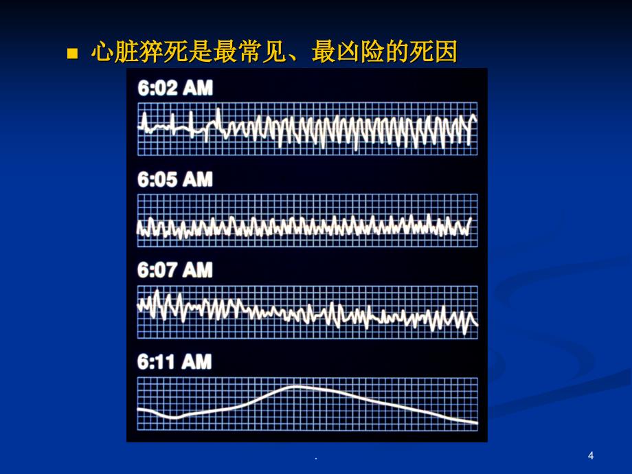 心脏骤停与心脏性猝死PPT幻灯片.ppt_第4页