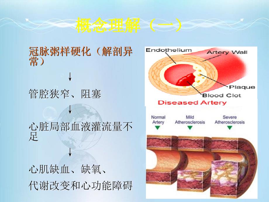 冠心病心绞痛的治疗ppt课件_第4页