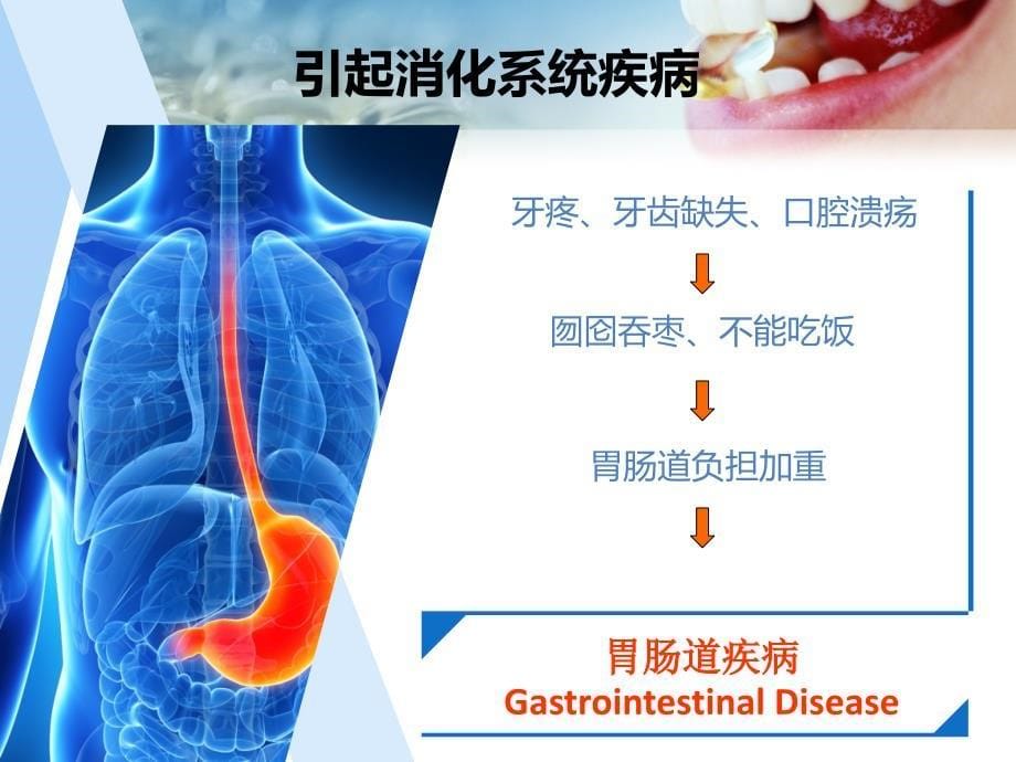 口腔疾病的预防与治疗_第5页