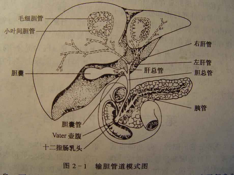 胆石症病人的护理课件_第4页