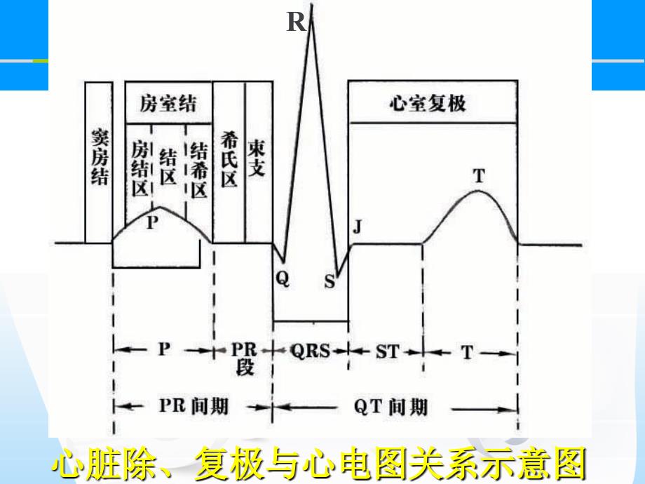 心电图基础图解_第3页