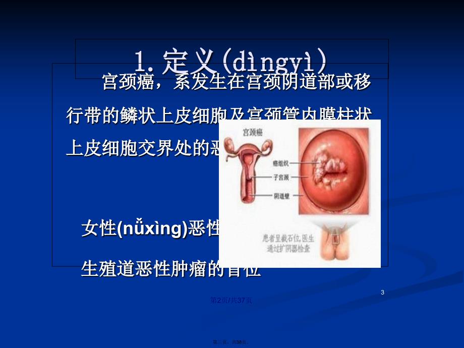 宫颈癌学习教案_第3页