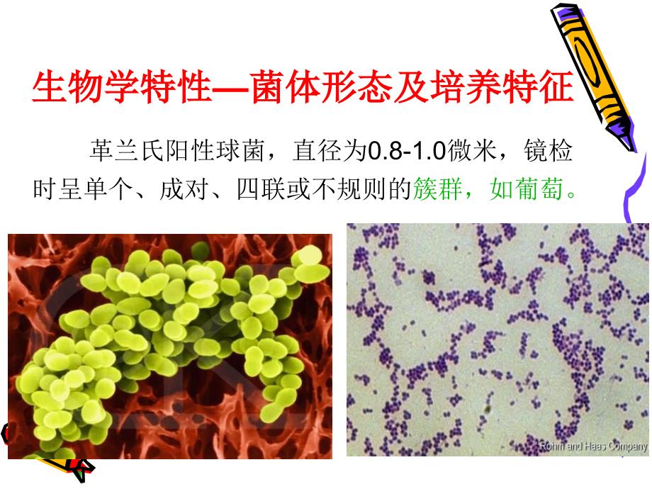 第四节金黄色葡萄球菌检验课件_第4页