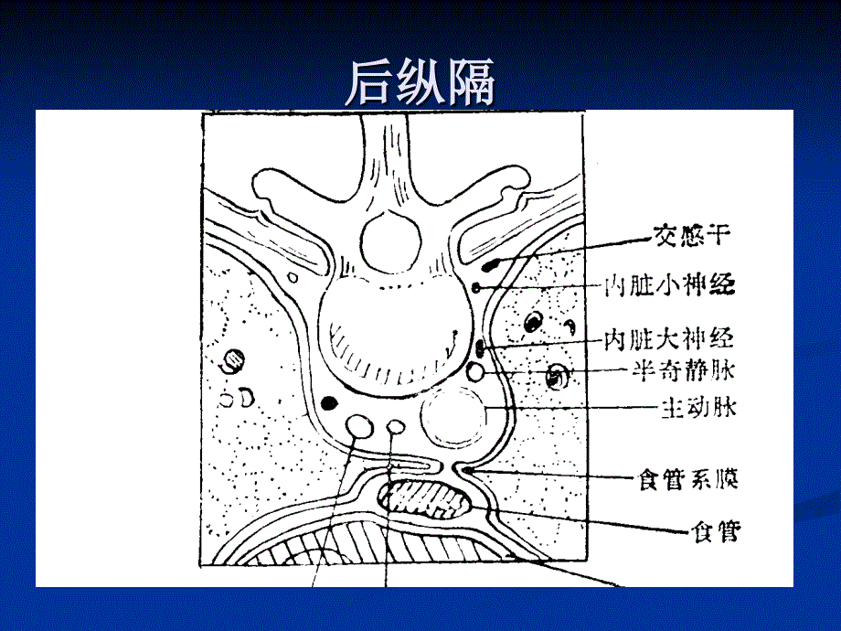 后纵隔肿瘤影像表现课件.ppt_第3页