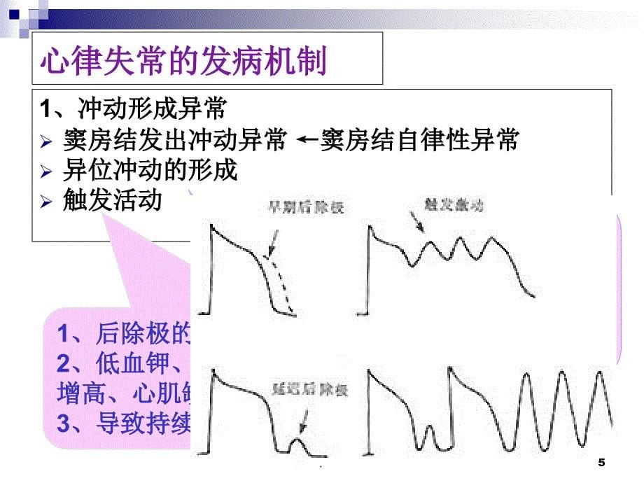 心律失常概述PPT文档资料_第5页