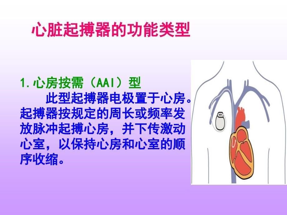 永久起搏器术后护理_第5页