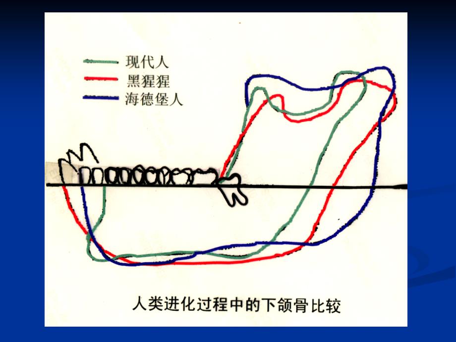 炎症智齿冠周炎_第4页