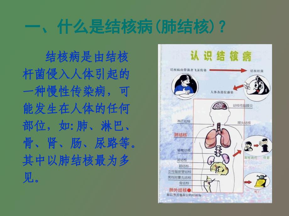 肺结核防治知识_第2页