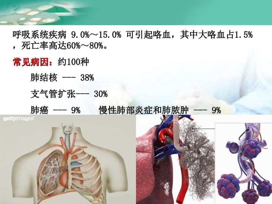 咯血介入治疗_第2页