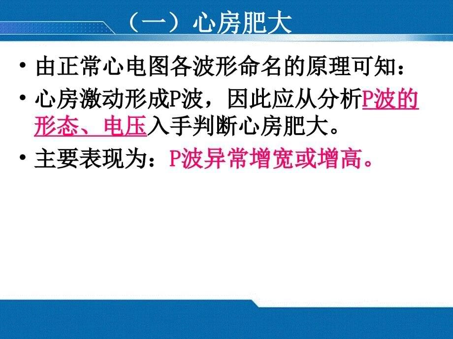 异常ECG修.ppt_第5页