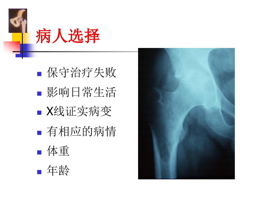 THA围手术期处理.ppt_第4页