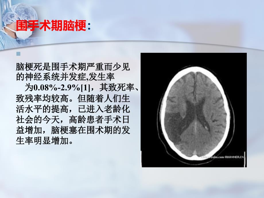 围手术期脑梗ppt课件.ppt_第2页