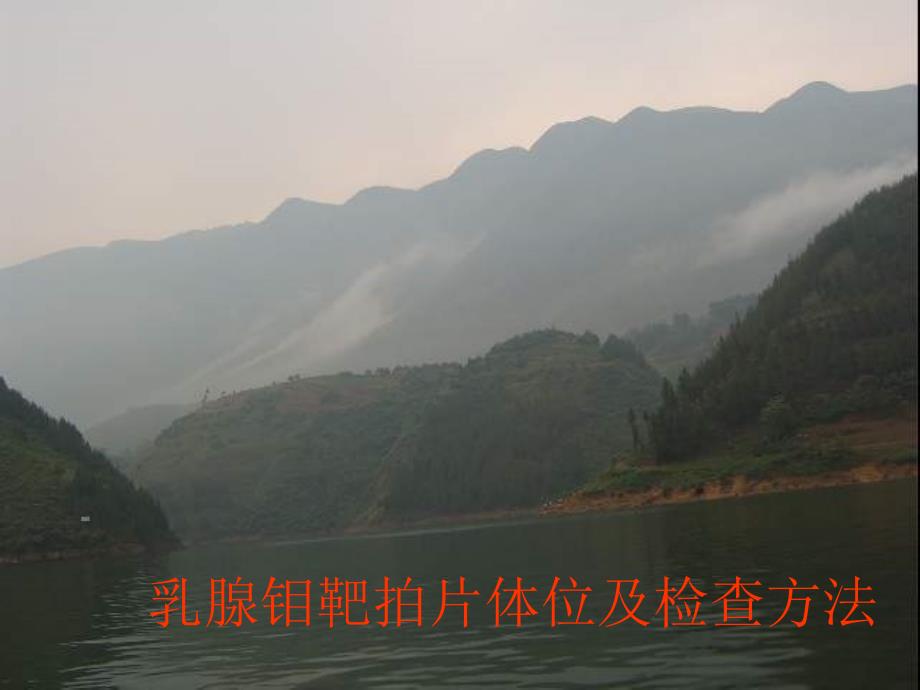乳腺钼靶拍片体位及检查方法 PPT课件.ppt_第1页
