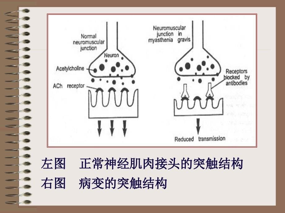 神精病学：神经肌肉接头与肌肉疾病_第5页